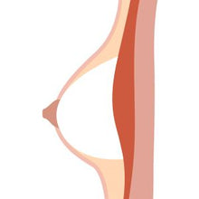 Hollow Breast Type