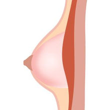 Jelly Breast Type